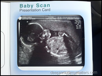 20 week scan