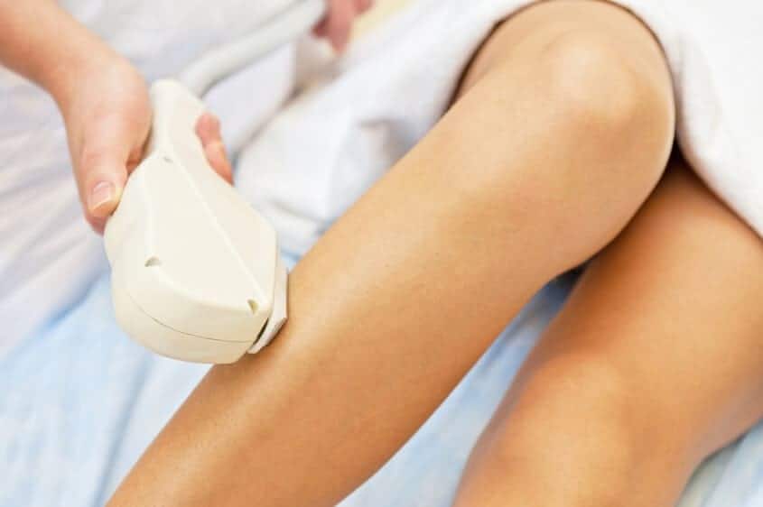 Laser Hair Removal