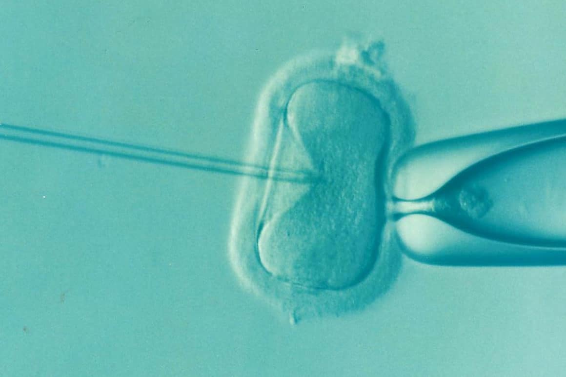 The Step-by-Step Guide to Fertility Treatment and What You Can Expect