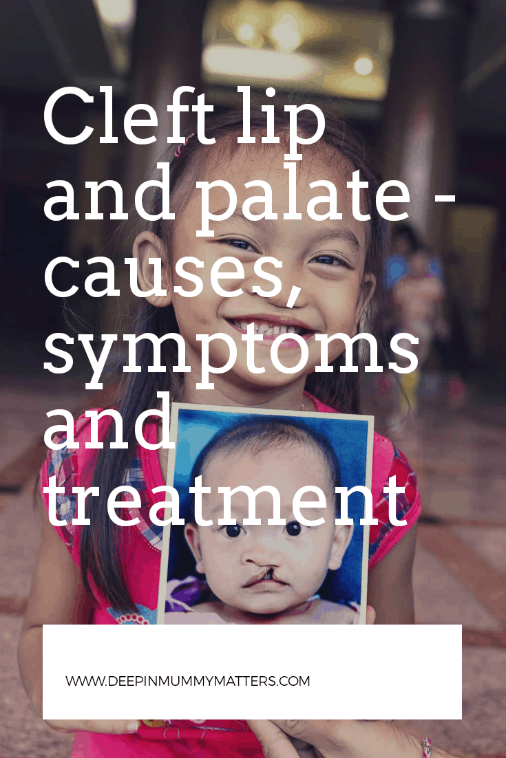 Cleft lip and palate - causes, symptoms and treatment