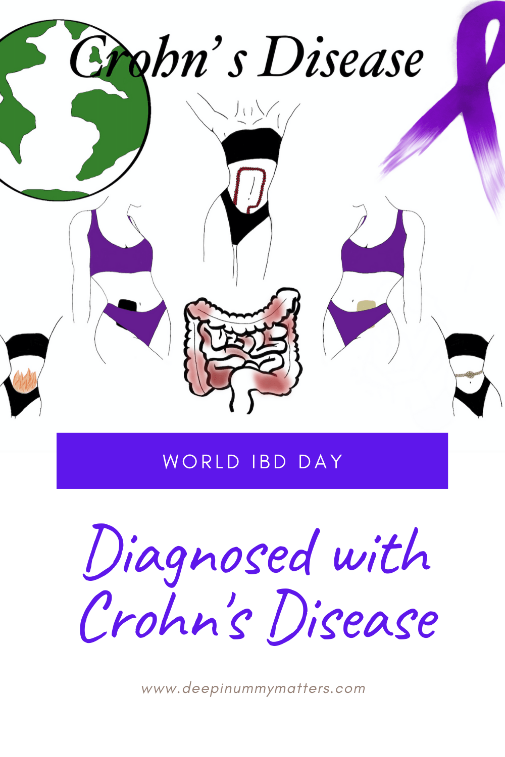 Today on World IBD Day I am handing over the reins to the beautiful Carla who was diagnosed at the beginning of 2020 with Crohn's Disease.