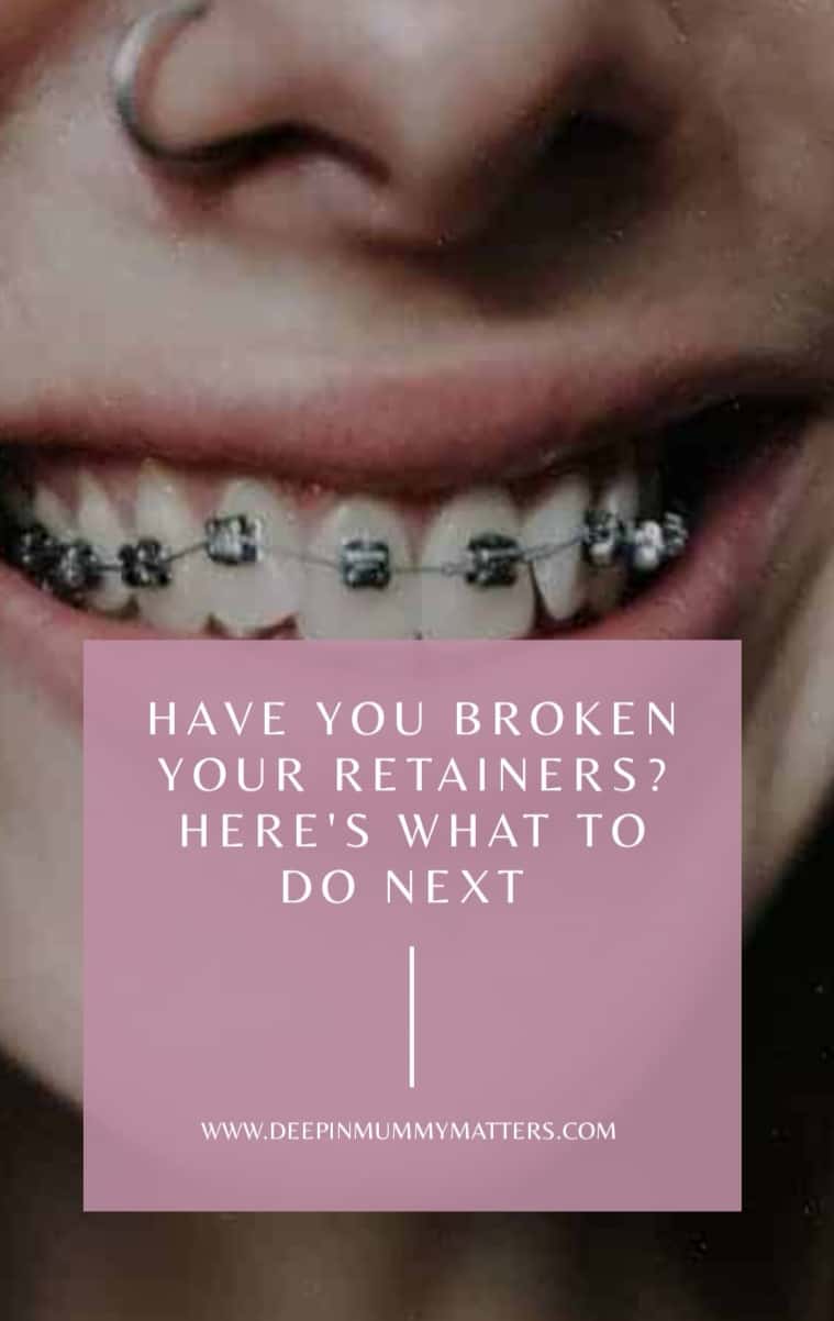 Have You Broken Your Retainers? Here’s What to Do Next 1