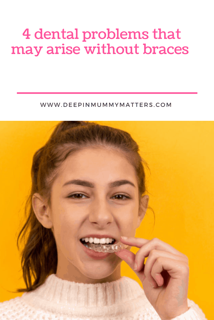 4 dental problems that may arise without braces 1