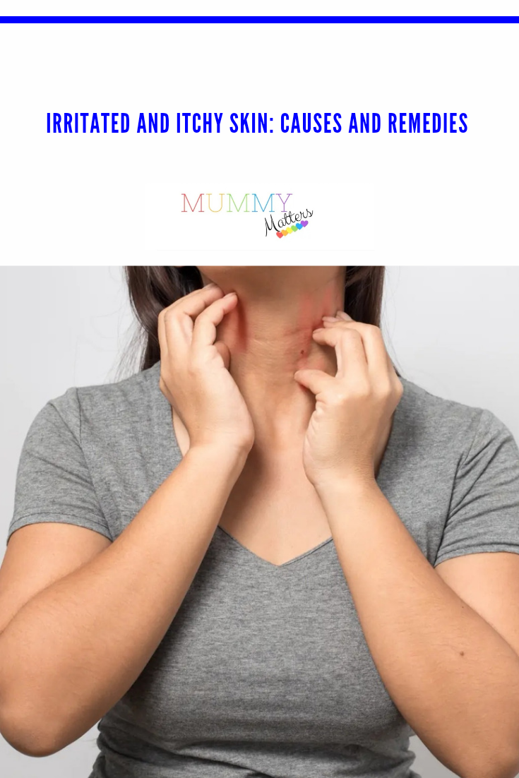 Irritated and Itchy Skin: Causes and Remedies 1