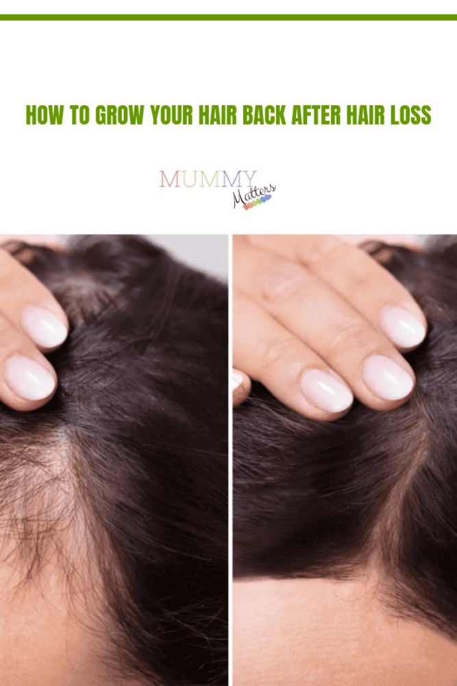 How to Grow Your Hair Back After Hair Loss Mummy Matters Parenting and Lifestyle