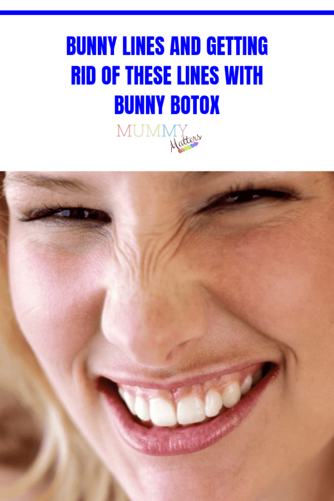 Bunny Lines and Getting Rid of These Lines with Bunny Botox Mummy