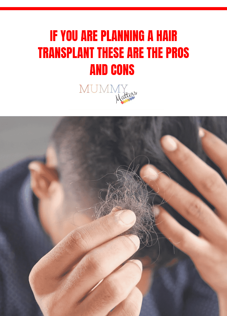 If You Are Planning A Hair Transplant These Are The Pros and Cons 1