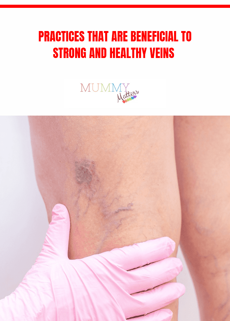 Practices That Are Beneficial To Strong And Healthy Veins 2