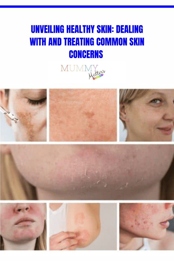 Unveiling Healthy Skin: Dealing with and Treating Common Skin Concerns 1