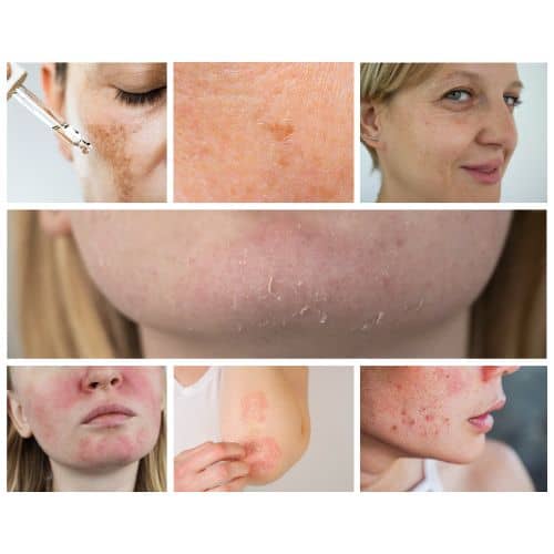 treating common skin concerns