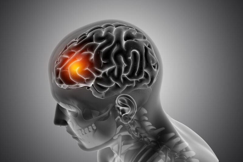 a human brain with a yellow spot